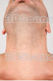 Neck texture of Dale 0001